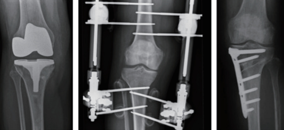 2025/2026 Surgery
